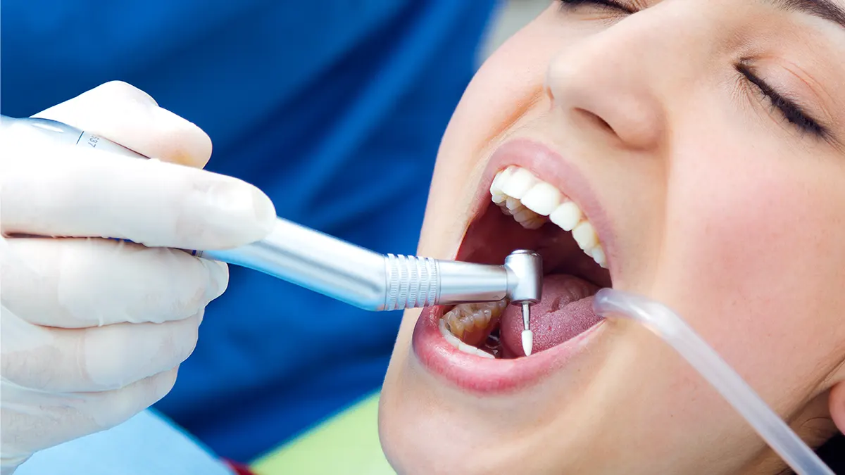 Kanal Tedavisi (Endodonti)
